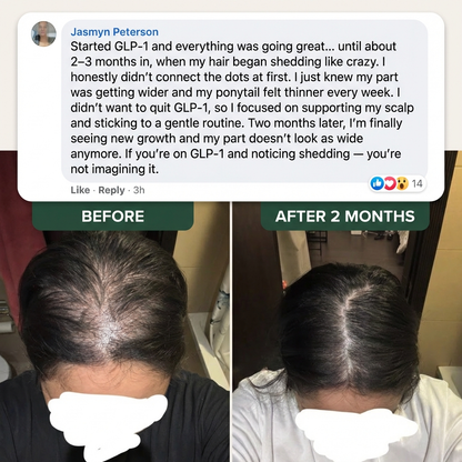 Rosemary Hair Growth Shampoo