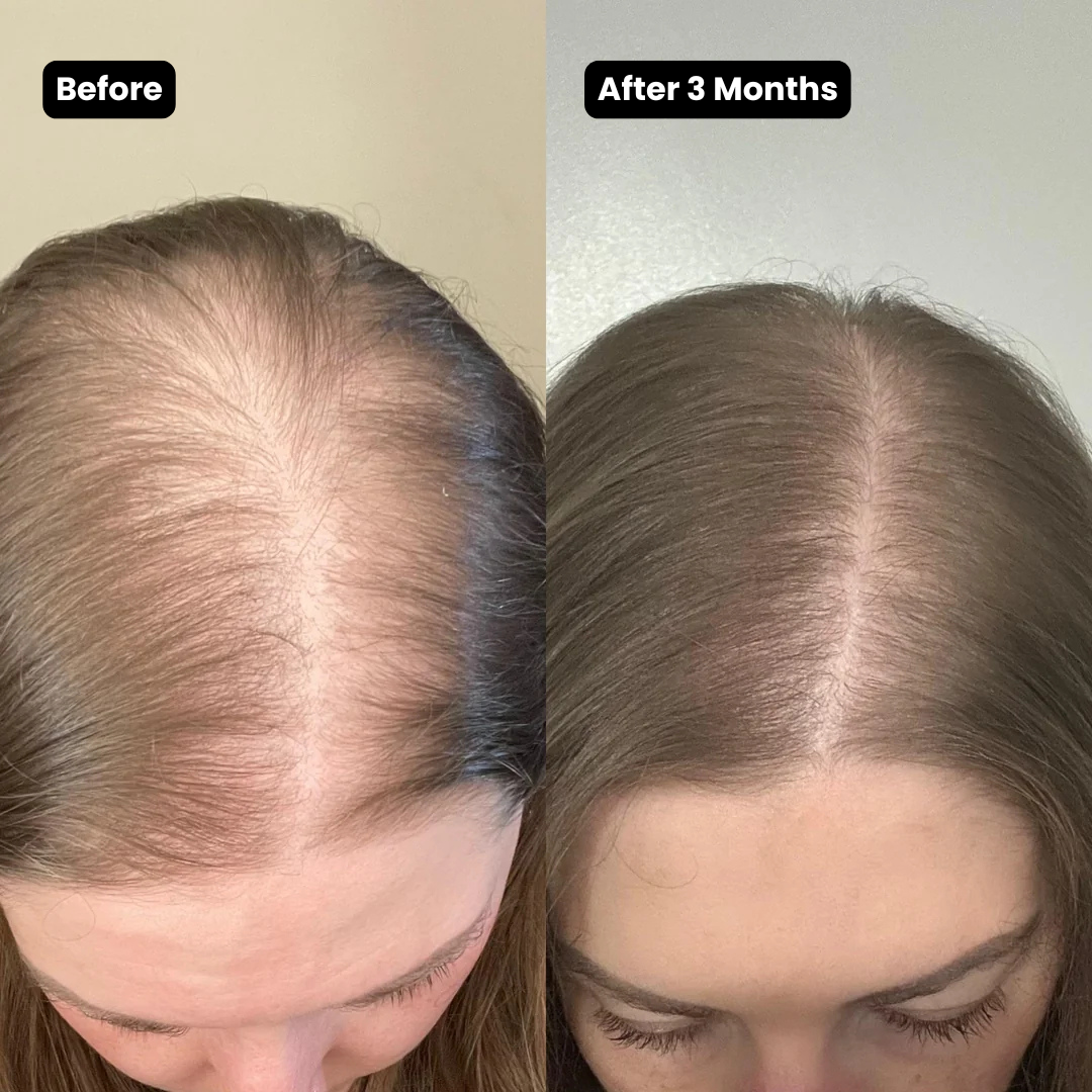 Korean Scalp Renewal Bar