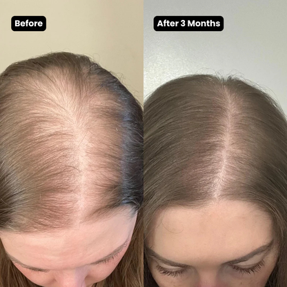Korean Scalp Renewal Bar