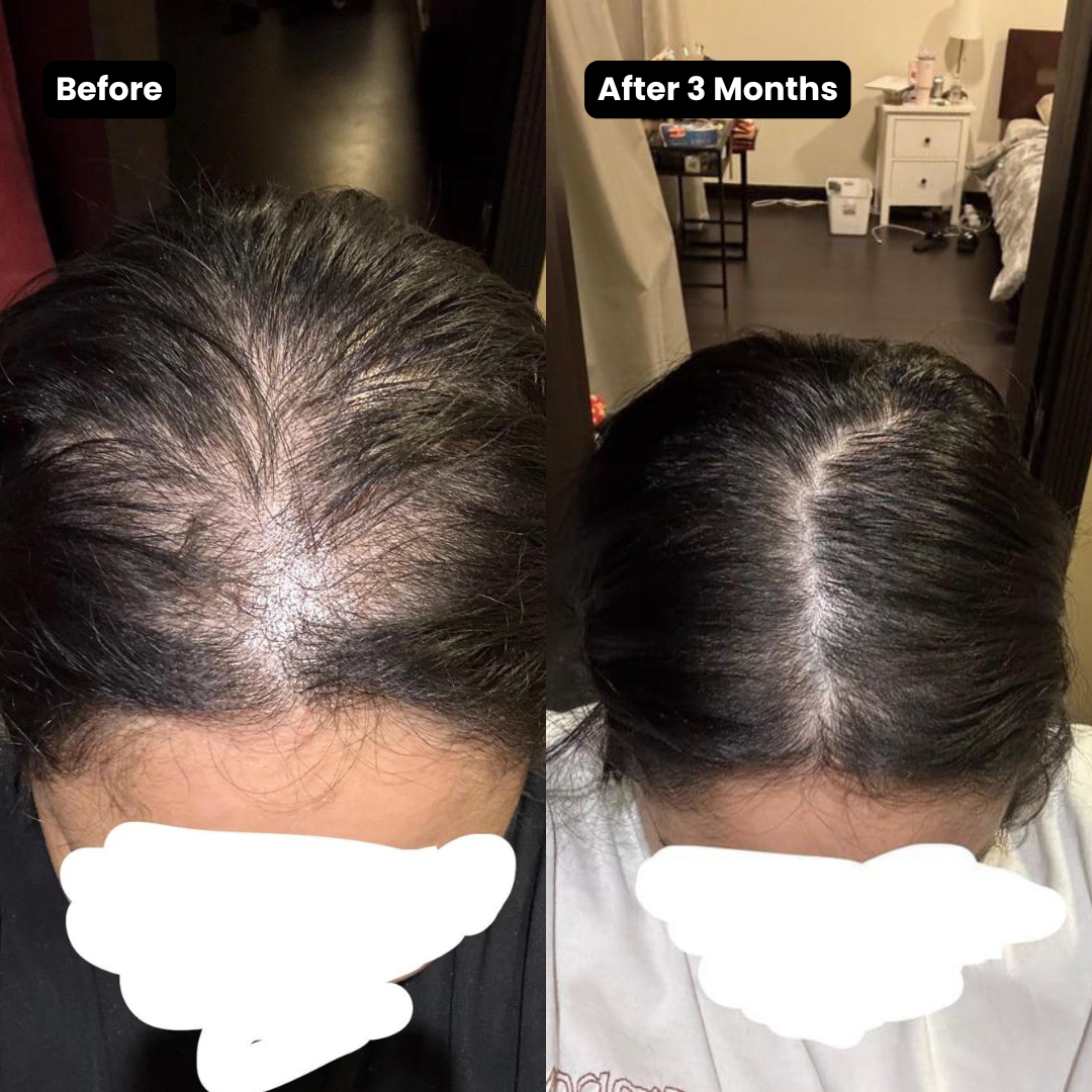 Korean Scalp Renewal Bar