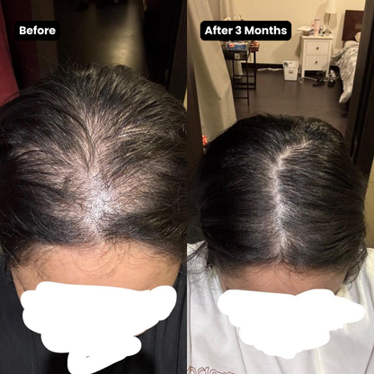 Korean Scalp Renewal Bar