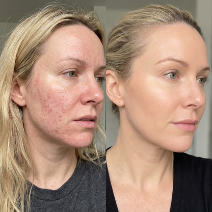 Pore Refining Cactus Balm