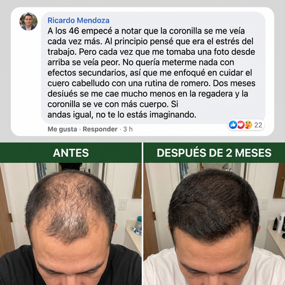 Champú de Crecimiento con Romero