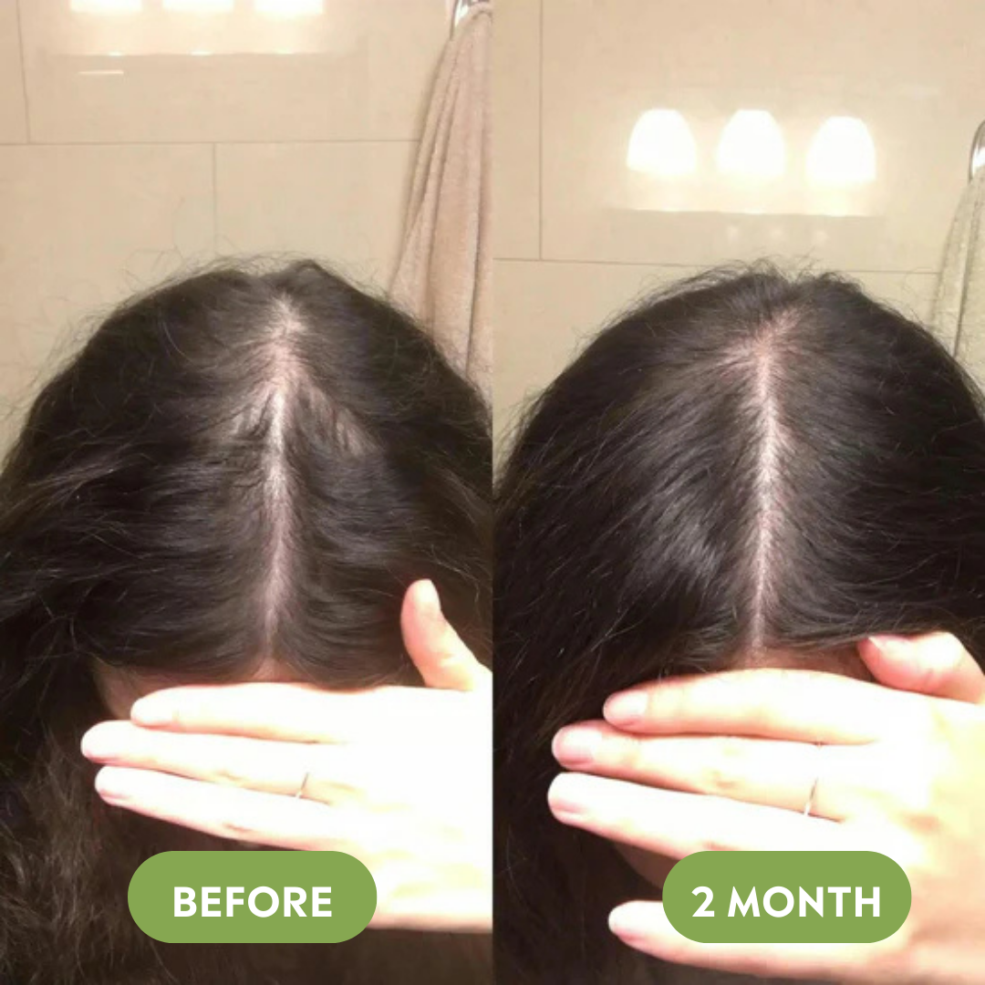 Rosemary Hair Growth Shampoo